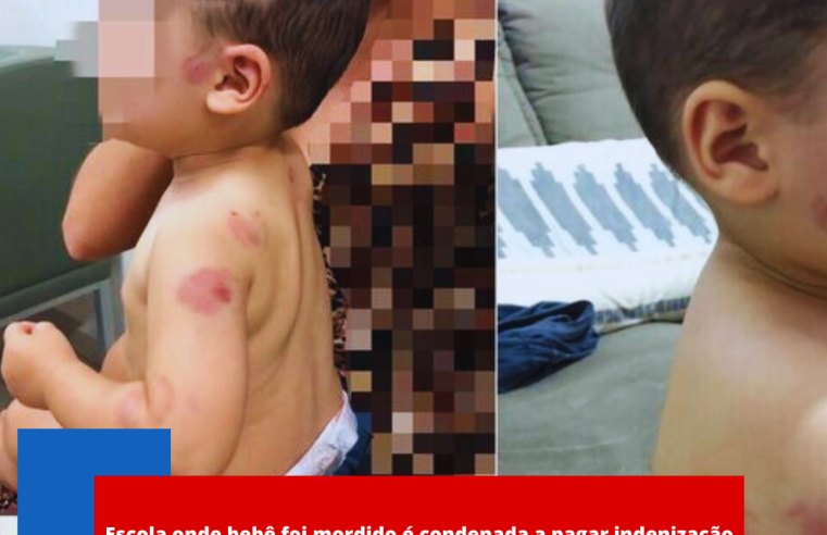 Escola onde bebê foi mordido é condenada a pagar indenização de mais de R$ 12 mil